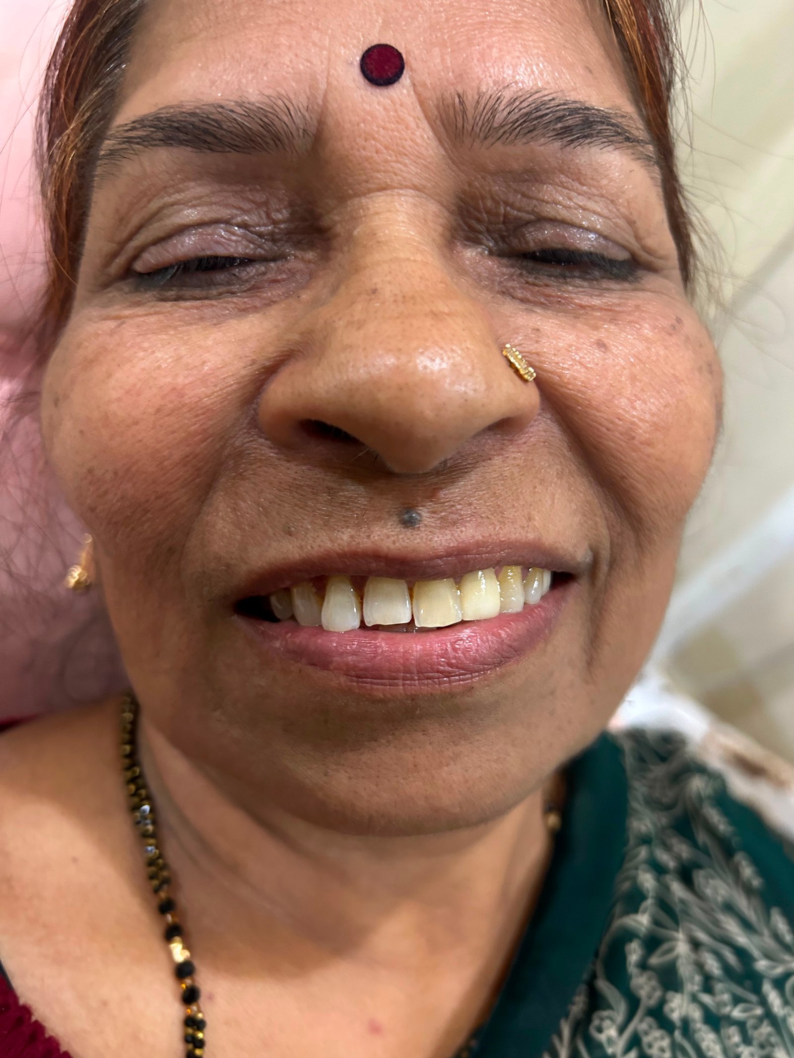 Patient smiling after dental care